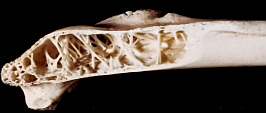 Interior of a bird bone showing struts or trabeculae