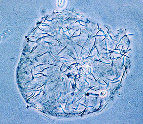 Photomicrograph of Budgerigar sperm on the surface of a hamster ovum