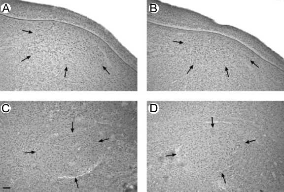 Micrographs of a song control area in a bird's brain