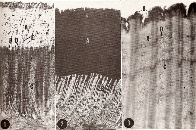 Photomicrographs of the walls of a chick gizzard