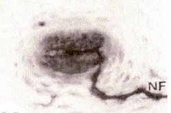 Micrograph of a Grandry corpuscle