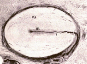 Micrograph of a Herbst corpuscle