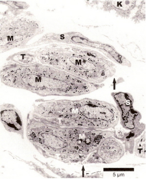 Micrograph showing Merkel cells