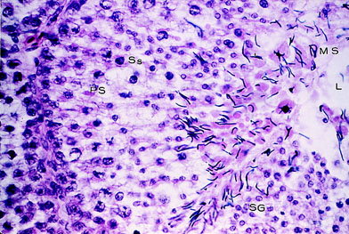 Photomicrograph of sperm in a seminiferous tubule