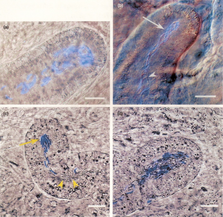 Photomicrographs of sperm storage tubules of domestic chickens and Wild Turkeys