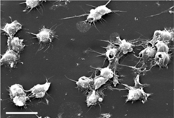 Photomicrograph of avian thrombocytes