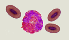 Micrograph of an eosinophil