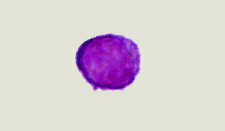 Micrograph of a lymphocyte