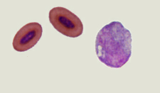 Micrograph of a monocyte