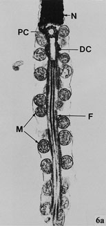 Transmission electron micrograph of the nucleus and midpiece of a Budgerigar spermatazoon