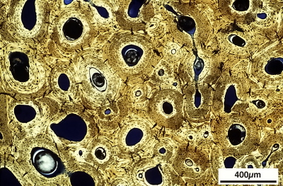 Dinosaur bone cross-section