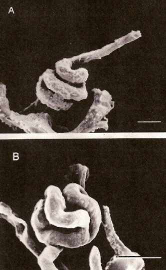 Photomicrographs of the glomeruli of a hummingbird