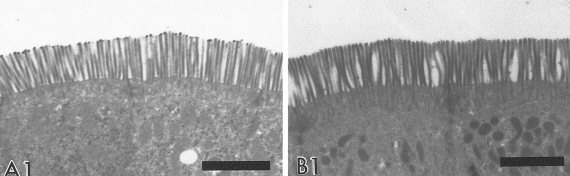 Photos of intestinal villi