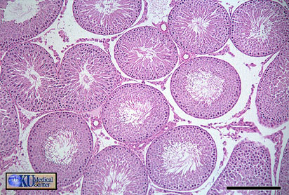 Micrograph of seminiferous tubules