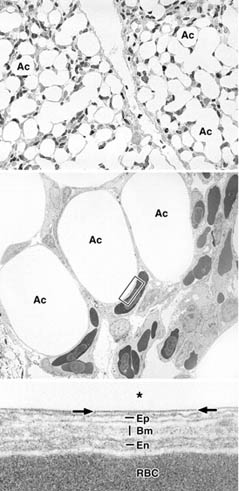 Morphology of a chicken lung