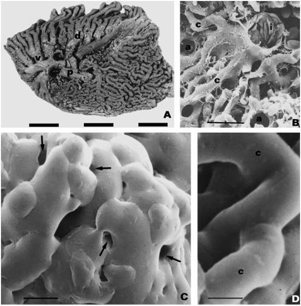 Photomicrographs of portions of the lung of a Domestic Chicken