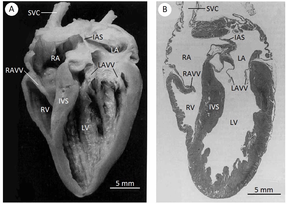 Avian Circulatory System