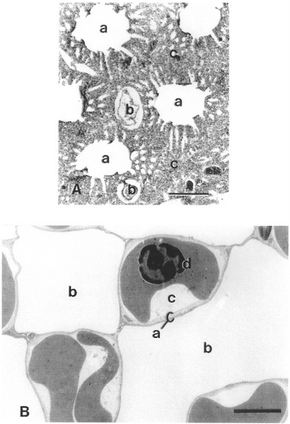 Photomicrograph of lung tissue of a Brown Honeyeater