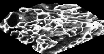 Drawing of air capillaries