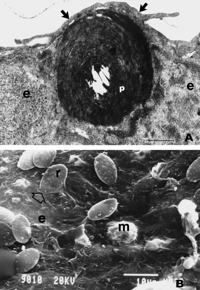 Photomicrograph of a particle engulfed by an epithelial cell in an avian lung